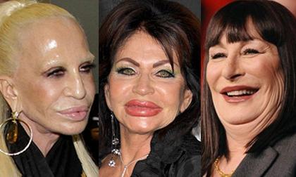 Sao nữ tự 'tàn phá' dung nhan vì lạm dụng 'dao kéo'