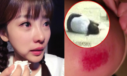 Liễu Nham mặt sưng vù vì bị ngã sõng soài lúc quay phim