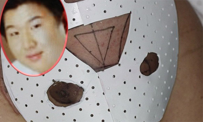 Lạ kỳ khuôn mặt 'mọc' trên ngực người đàn ông