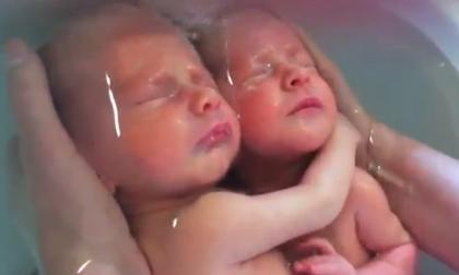 Cặp song sinh đáng yêu khiến người xem cảm động