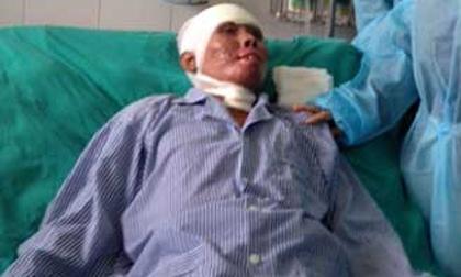 Vụ Mi171 rơi: Chiến sĩ duy nhất sống sót đã cử động được