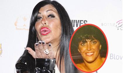 Sao truyền hình Mỹ lộ mặt như 'yêu tinh' vì lạm dụng thẩm mỹ