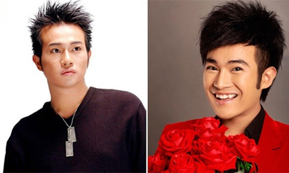 Sao nam Việt dính nghi án phẫu thuật mũi và cằm