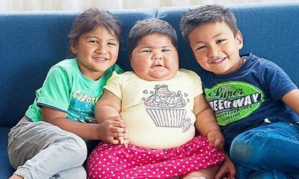 Mắc bệnh lạ, em bé 10 tháng lớn bằng trẻ 5 tuổi