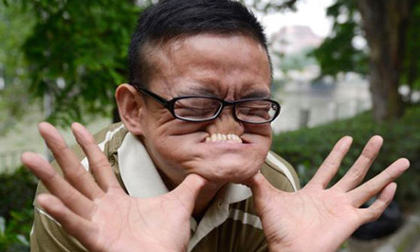 Dị nhân có khả năng làm khuôn mặt biến dạng kinh hoàng