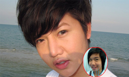 Hành trình 8 năm dao kéo của “trai đẹp” Thái Lan