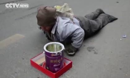 Sự thật về người đàn ông bò lê ăn xin