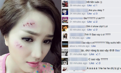 Fans hoang mang trước cảnh Bảo Thy mặt đầy thương tích