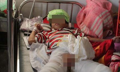 Trừ thói ăn trộm vặt, bố chất rơm đốt con