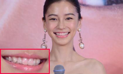 Angela Baby như nhuộm răng hồng vì bị lem son