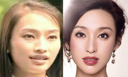 Diễn viên Trương Lệ bị nghi 'dao kéo' vì lộ ảnh cũ xấu xí