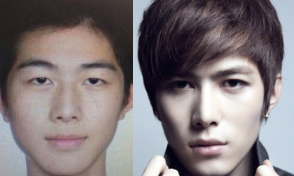 Mỹ nam 'Tiểu thời đại 3' lộ dấu vết thẩm mỹ