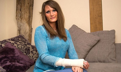 Người phụ nữ chỉ ngáp ngủ cũng bị trật khớp