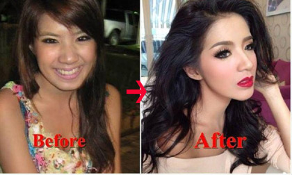"Sốc" với nhan sắc trước và sau thẩm mỹ của loạt sao Thái Lan