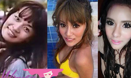 9 ca phẫu thuật thẩm mỹ sốc nhất 2013 của sao Thái