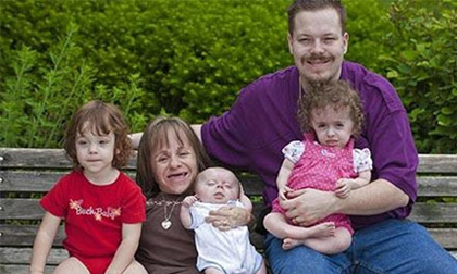 Điểm mặt những người lùn nổi tiếng trên thế giới