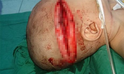 Tội phạm tâm thần sát hại người thân: Nỗi đắng cay ở lại