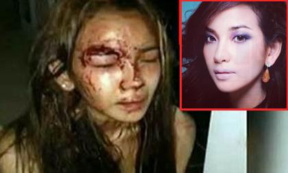 Nữ diễn viên nổi tiếng Thái Lan bị thợ xây đánh đập và cưỡng hiếp