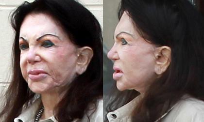 "Hoảng" vì khuôn mặt "chảy nhão" của sao nữ 92 tuổi nghiện thẩm mỹ