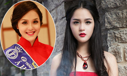 Á hậu Hoàng Anh độn cằm quá dài?