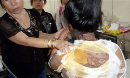 “Nữ quái” tạt nồi lẩu đang sôi vào người khác để “dằn mặt”