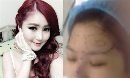Những vụ 'lộ' vết tích phẫu thuật thẩm mỹ của kiều nữ Việt