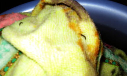 Đã có kết quả xét nghiệm vụ khăn tắm "nở" ra ấu trùng lạ