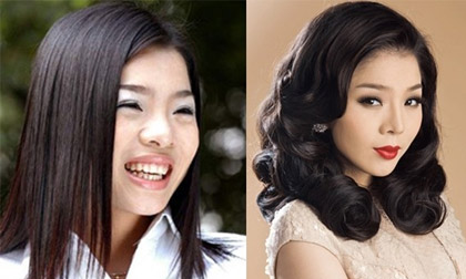 Những sao Á dũng cảm thừa nhận phẫu thuật thẩm mỹ