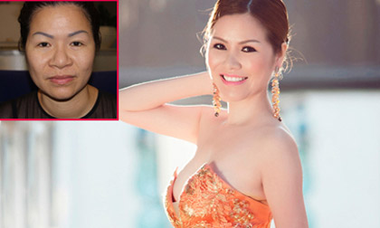 Hoa hậu Quý bà trẻ đẹp như hotgirl sau phẫu thuật