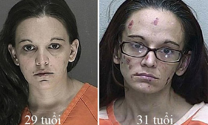 Rợn người những khuôn mặt bị tàn phá do tác hại của ma túy