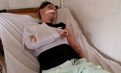 Hot boy Kelbin Lei gặp tai nạn nghiêm trọng vì bị cướp