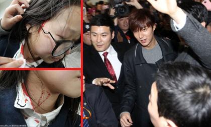 Fans nữ xô đẩy tóe máu để nhìn Lee Min Ho
