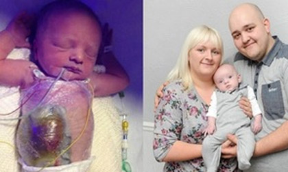 Cậu bé có ruột lòi ra khỏi ổ bụng