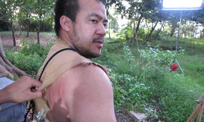 Hiếu Hiền bầm dập vì tự thân đóng cảnh nguy hiểm