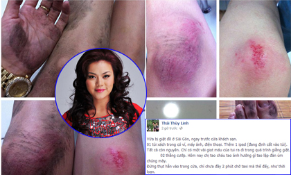 "Kinh hoàng" Hải Yến Idol và Thái Thùy Linh bị cướp giật