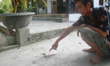 Cắt cổ vợ sắp cưới rồi tự tử: Nạn nhân đã tỉnh