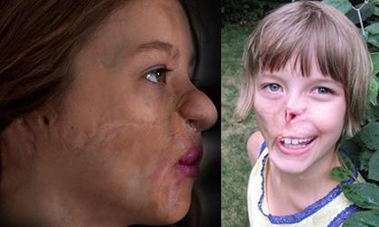 Hình ảnh đáng thương của bé gái bị gấu trúc tấn công