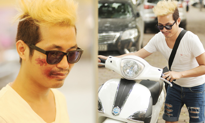 Bạn bè và người thân lo lắng ông bầu Tommy bị té xe