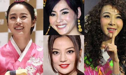 Mỹ nhân Châu Á 'đau đầu' vì dấu vết tuổi tác