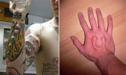 Những hình thức làm đẹp ‘chịu chơi’ ít ai dám thử