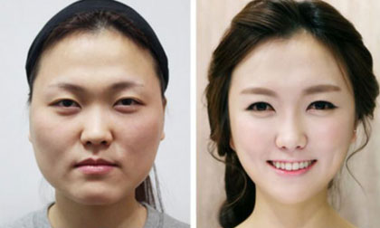 Hàng loạt phụ nữ phải làm lại hộ chiếu vì... phẫu thuật thẩm mỹ quá xinh