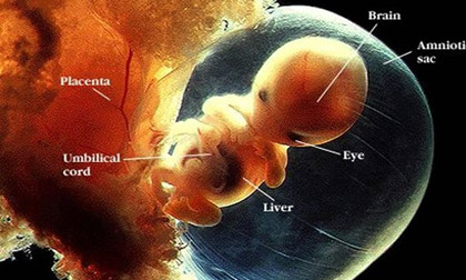 Dấu hiệu nhận biết tình trạng thiếu ối ở mẹ bầu