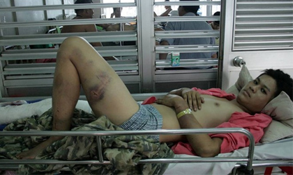 Bắt hung thủ đánh gãy chân người yêu của con gái