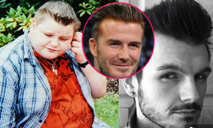 Cậu bé 150kg giảm cân thành công vì muốn giống Beckham