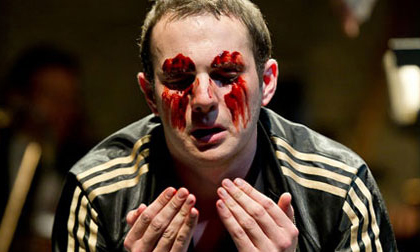 Rùng rợn người chết bị móc mắt