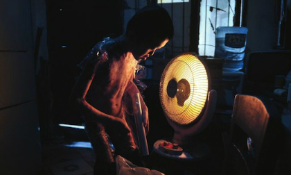 Cậu bé mắc quái bệnh phải bọc màng thực phẩm đến trường