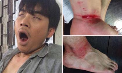 Trương Nam Thành bị bầm dập, tóe máu vì vào vai nghiện