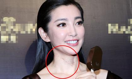 Lý Băng Băng lộ "vết tích" khó hiểu trên cổ