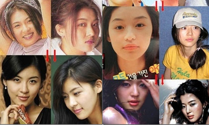 Lộ ảnh xấu xí trước khi thẩm mỹ của loạt sao đình đám xứ Hàn