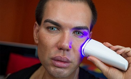 Anh chàng búp bê sống phiên bản nam nghiện phẫu thuật thẩm mỹ